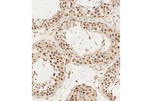 (ABIN1538275 and ABIN2849896) staining ALKBH5 in human testis tissue sections by Immunohistochemistry (IHC-P - paraformaldehyde-fixed, paraffin-embedded sections). (ALKBH5 抗体  (AA 302-330))