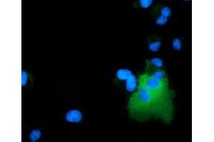 Image no. 3 for anti-rho GTPase Activating Protein 25 (ARHGAP25) antibody (ABIN1496703) (ARHGAP25 抗体)