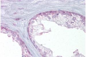 Immunohistochemical staining (Formalin-fixed paraffin-embedded sections) of human prostate with EDF1 polyclonal antibody . (EDF1 抗体  (AA 99-148))