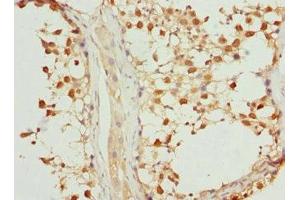 Immunohistochemistry of paraffin-embedded human testis tissue using ABIN7169217 at dilution of 1:100 (VRK1 抗体  (AA 257-396))