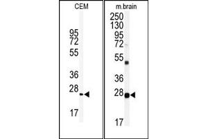 Image no. 2 for anti-Ubiquitin Carboxyl-terminal Esterase L1 (Ubiquitin Thiolesterase) (UCHL1) (N-Term) antibody (ABIN357509) (UCHL1 抗体  (N-Term))