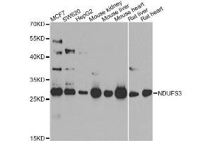 Western blot analysis of extracts of various cell lines, using NDUFS3 antibody. (NDUFS3 抗体)