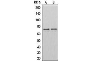 Western blot analysis of DMPK expression in HeLa (A), Jurkat (B) whole cell lysates. (DMPK 抗体  (N-Term))