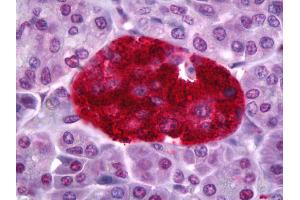 Immunohistochemistry (IHC) image for anti-Protein Tyrosine Phosphatase, Receptor Type, N (PTPRN) antibody (ABIN961567)