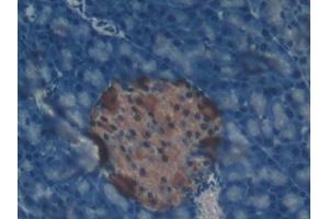 Detection of CAT in Mouse Pancreas Tissue using Polyclonal Antibody to Catalase (CAT)