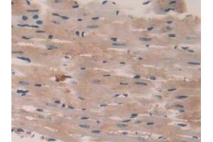 Immunohistochemistry (IHC) image for anti-Protein tyrosine Phosphatase, Receptor Type, B (PTPRB) (AA 1041-1310) antibody (ABIN7443743)