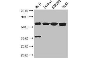 Western Blot Positive WB detected in: Raji whole cell lysate, Jurkat whole cell lysate, HEK293 whole cell lysate, U251 whole cell lysate All lanes: KPNA2 antibody at 3 μg/mL Secondary Goat polyclonal to rabbit IgG at 1/50000 dilution Predicted band size: 58 kDa Observed band size: 58 kDa (KPNA2 抗体  (AA 2-285))