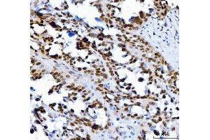 IHC analysis of SP1 using anti-SP1 antibody (ABIN7601559). (SP1 抗体  (AA 384-603))