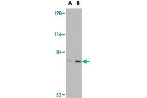 Western blot analysis of LRFN5 in EL4 cell lysate with LRFN5 polyclonal antibody  at (A) 0. (LRFN5 抗体  (C-Term))