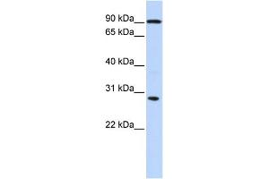 WB Suggested Anti-BOLL Antibody Titration:  0. (BOLL 抗体  (N-Term))
