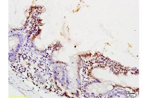 Formalin-fixed and paraffin embedded rat colon tissue labeled with Anti-PPAR alpha Polyclonal Antibody, Unconjugated (ABIN701620) at 1:200 followed by conjugation to the secondary antibody (PPARA 抗体  (AA 301-400))