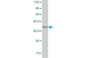 Western Blot detection against Immunogen (35. (SYN1 抗体  (AA 362-450))