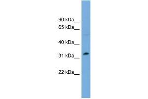 Human OVCAR-3; WB Suggested Anti-PHF13 Antibody Titration: 0. (PHF13 抗体  (Middle Region))