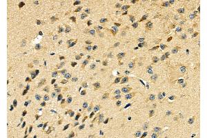 ABIN6264833 and ABIN6279044 at 1/100 staining Mouse brain tissue by IHC-P. (RPL29 抗体  (Internal Region))