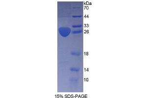 SDS-PAGE analysis of Human ARNT2 Protein. (ARNT2 蛋白)