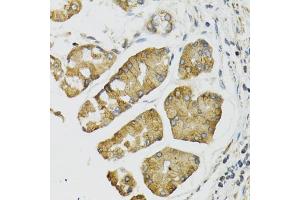 Immunohistochemistry of paraffin-embedded human esophagus using PI3 antibody (ABIN6293676) at dilution of 1:100 (40x lens). (PI3 抗体)