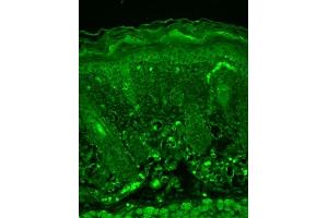 Immunohistochemistry analysis using Mouse Anti-Rhodopsin Monoclonal Antibody, Clone 1D4 (ABIN863084 and ABIN863085). (Rhodopsin 抗体)