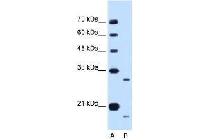 WB Suggested Anti-CCPG1 Antibody Titration:  0.