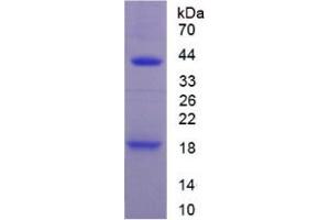 SDS-PAGE analysis of Mouse IL1R1 Protein. (IL1R1 蛋白)