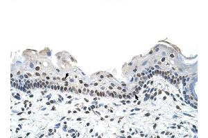 RBM28 antibody was used for immunohistochemistry at a concentration of 4-8 ug/ml to stain Squamous epithelial cells (arrows) in Human Skin. (RBM28 抗体  (C-Term))