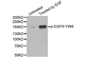 Western Blotting (WB) image for anti-Epidermal Growth Factor Receptor (EGFR) (pTyr1016) antibody (ABIN1870114) (EGFR 抗体  (pTyr1016))