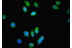 Immunofluorescent analysis of A549 cells using ABIN7159025 at dilution of 1:100 and Alexa Fluor 488-congugated AffiniPure Goat Anti-Rabbit IgG(H+L) (SPG21 抗体  (AA 1-308))