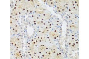 Immunohistochemistry of paraffin-embedded Rat kidney using STAT4 Polyclonal Antibody at dilution of 1:100 (40x lens). (STAT4 抗体)