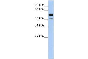Western Blotting (WB) image for anti-Deoxyribonuclease II beta (DNASE2B) antibody (ABIN2458670) (DNASE2B 抗体)