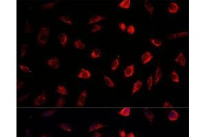 Immunofluorescence analysis of L929 cells using NEDD1 Polyclonal Antibody at dilution of 1:100. (NEDD1 抗体)