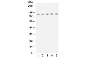 Western blot testing of 1) rat testis, 2) rat ovary, 3) human SKOV, 4) COLO320 and 5) human HeLa lysate with TRIM28 antibody. (KAP1 抗体  (AA 699-835))