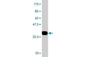 Western Blot detection against Immunogen (36. (EPM2AIP1 抗体  (AA 508-606))