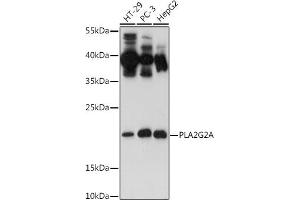 Western blot analysis of extracts of various cell lines, using PLG2A antibody (ABIN3021801, ABIN3021802, ABIN3021803 and ABIN6215942) at 1:500 dilution. (PLA2G2A 抗体  (AA 21-144))