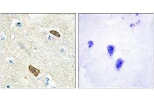 Immunohistochemistry analysis of paraffin-embedded human brain, using PLXDC1 Antibody. (PLXDC1 抗体  (AA 71-120))