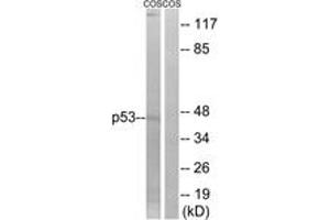 Western blot analysis of extracts from COS7 cells, treated with UV, using p53 (Ab-9) Antibody. (p53 抗体  (AA 8-57))