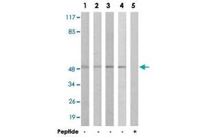 Western blot analysis of extracts from COLO cells (Lane 1 and 5), HT-29 cells (Lane 2), A-549 cells (Lane 3) and 293 cells (Lane 4), using IL13RA1 polyclonal antibody . (IL13 Receptor alpha 1 抗体)