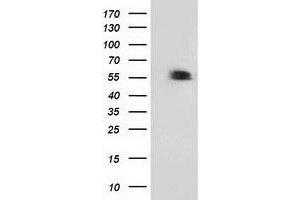 HEK293T cells were transfected with the pCMV6-ENTRY control (Left lane) or pCMV6-ENTRY TP53 (Right lane) cDNA for 48 hrs and lysed. (p53 抗体)