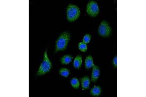 Immunofluorescence (IF) image for anti-Complement Factor H (CFH) antibody (ABIN2995930)