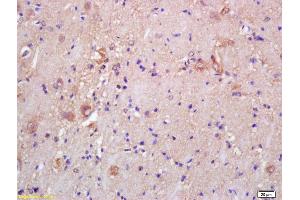 Formalin-fixed and paraffin embedded rat brain labeled with Rabbit Anti CKMT/Creatine kinase MT Polyclonal Antibody, Unconjugated (ABIN717536) at 1:200 followed by conjugation to the secondary antibody and DAB staining