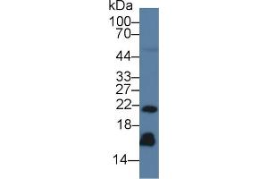 Western blot analysis of Human Serum, using Human REG3g Antibody (3 µg/ml) and HRP-conjugated Goat Anti-Mouse antibody ( (REG3g 抗体  (AA 39-175))