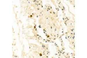 Immunohistochemistry (Paraffin-embedded Sections) (IHC (p)) image for anti-SIX Homeobox 1 (SIX1) antibody (ABIN7075617)