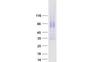 Western Blotting (WB) image for Calcium Channel, Voltage-Dependent, gamma Subunit 5 (CACNG5) (Transcript Variant 1) protein (Myc-DYKDDDDK Tag) (ABIN2713011)