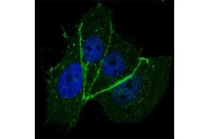 Fluorescent confocal image of MCF7 cells stained with phospho-ERBB2 antibody at 1:100.