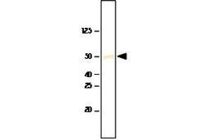 Recombinant SET7/9 was resolved by electrophoresis, transferred to PVDF membrane and probed with anti-SET7/9(1:1,000). (SET7/9 抗体  (AA 1-366))