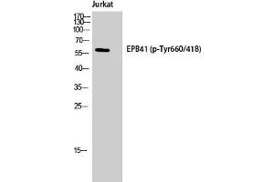 Western Blot (WB) analysis of Jurkat cells using Phospho-4. (EPB41 抗体  (pTyr660))
