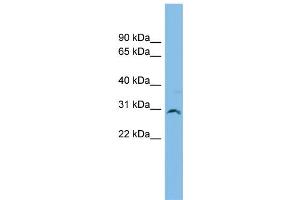 WB Suggested Anti-SNF8 Antibody Titration: 0. (SNF8 抗体  (Middle Region))