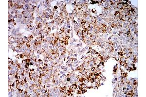 Immunohistochemistry (IHC) image for anti-Toll-Like Receptor 9 (TLR9) (AA 868-1016) antibody (ABIN5896728) (TLR9 抗体  (AA 868-1016))