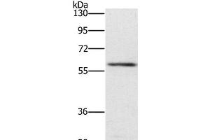 Western Blot analysis of Mouse spleen tissue using TRAFD1 Polyclonal Antibody at dilution of 1:400 (TRAFD1 抗体)