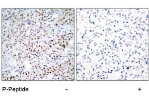 Image no. 1 for anti-cAMP Responsive Element Binding Protein 1 (CREB1) (pSer133) antibody (ABIN196704) (CREB1 抗体  (pSer133))
