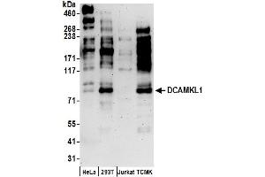 Western Blotting (WB) image for anti-Doublecortin-Like Kinase 1 (DCLK1) (AA 690-740) antibody (ABIN7450985)