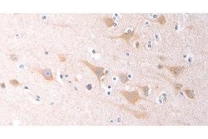 Immunohistochemistry of paraffin-embedded Human brain tissue using SCGB1A1 Polyclonal Antibody at dilution 1:60